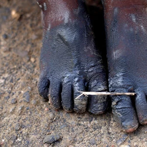 A Rohingya refugee boys feet are covered with mud after crossing the Bangladesh-Myanmar