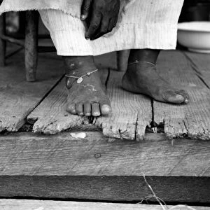 SHARECROPPER, 1937. A fifty-seven year old African American sharecroppers feet