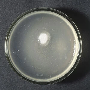 Yeast culture in petri dish, view from above