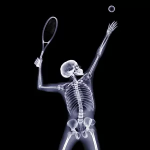 Person serving tennis ball, X-ray