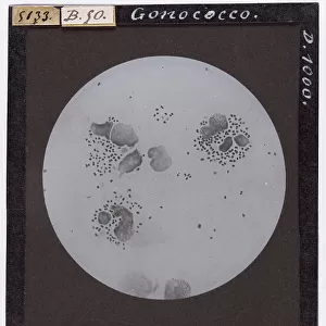 Gonococco: bacteria enlarged under a microscope