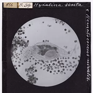 Hydatina scrita and Hematacoccus nivalis micro-organisms, enlarged under a microscope