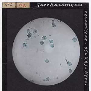 Microscopic enlargment of Saccharomyces Cerevisiae